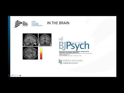 Anxiety and Hypermobility - Dr. Jessica Eccles | English (EN)