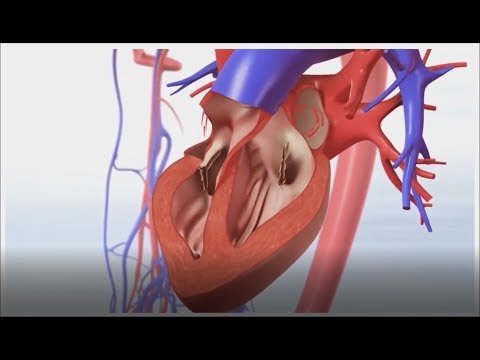 Left Atrial Appendage Closure: State of the Art