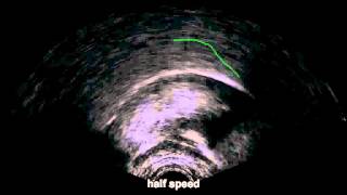 Northern Ireland Young Female NURSE.avi