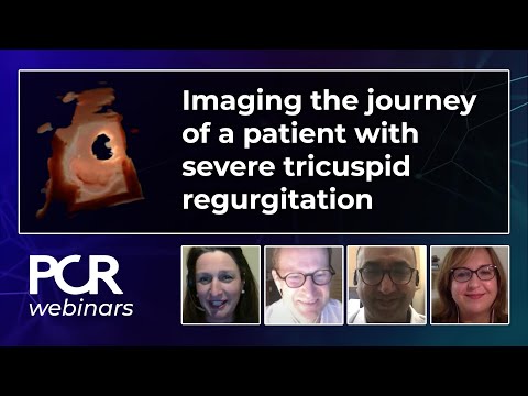 Imaging the journey of a patient with severe tricuspid regurgitation - Webinar