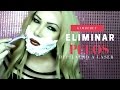 COMO ELIMINEI PELOS INDESEJÁVEIS COM DEPILAÇÃO A LASER