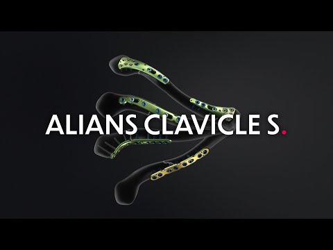 Alians Clavicle S - Management of clavicle fractures