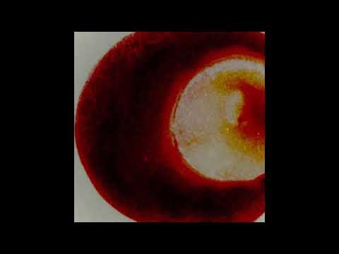 【G2R2018】xuxuezique - ophthalmomyiasis【BGA】