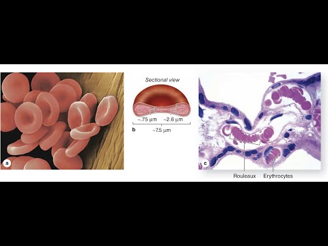 Erythrocytes| Chapter 12 BLOOD| JUNQUEIRA'S Basic Histology| Red Blood Cells