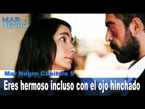 Eres hermoso incluso con el ojo hinchado - Mar Negro Las Escenas