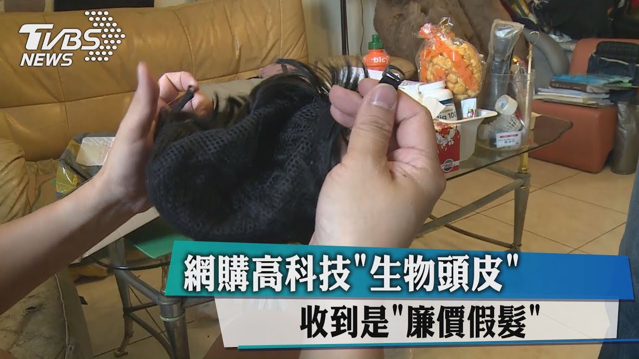 網購高科技「生物頭皮」 收到是「廉價假髮」