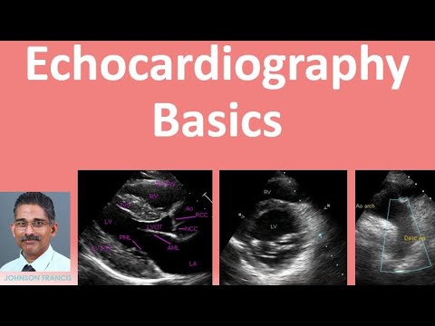 What is Echocardiography