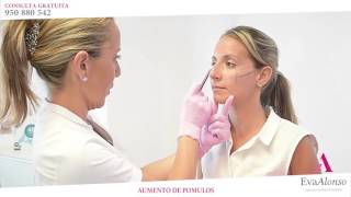 Medicina Estetica, ácido hialurónico, eliminación de arrugas - Clínica Eva Alonso