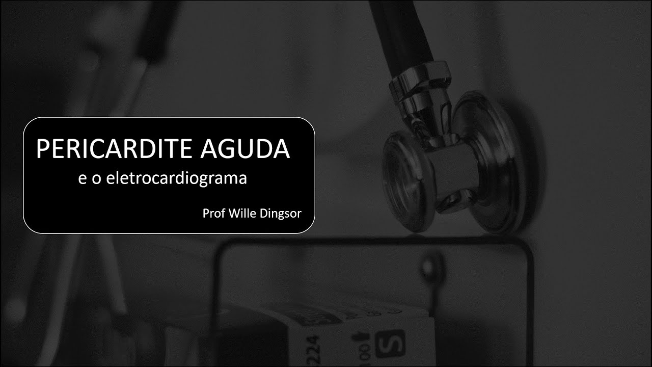Pericardite Aguda e o ECG