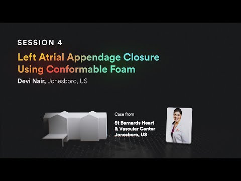 Left Atrial Appendage Closure: Innovative Conformable Foam Technique