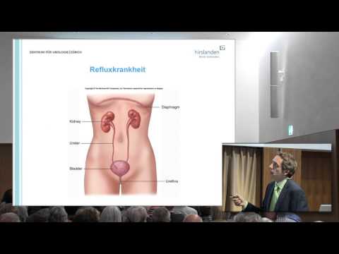 Prostatakrebs Standards der Pflege Tennisball für Prostata