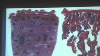 24) Dr.Gihan 02/04/2014 [Nervous tissue]