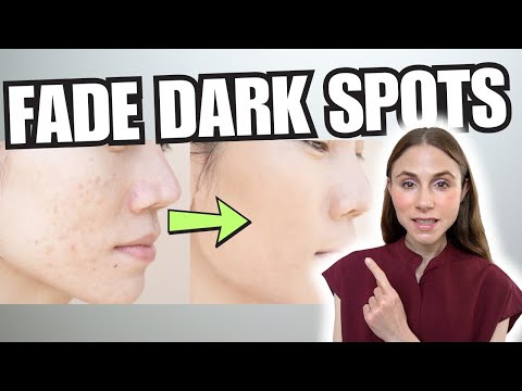 Dark Spots on the Face: What Actually Works (Dermatologist Explains)