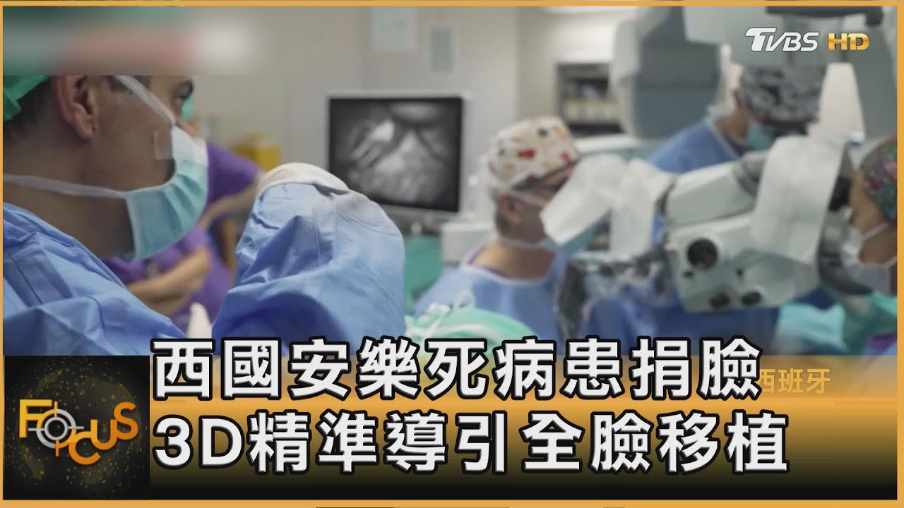 3D精準導引移植 西班牙安樂死病患捐臉 毀容女新生