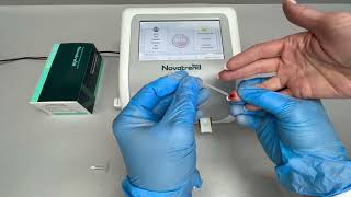 FIA testy k POCT analyzátoru / FIA Troponín-T test - video FIA testy k POCT analyzátoru / FIA Troponín-T test - video