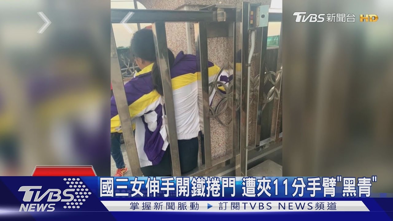 國三女伸手開鐵捲門 遭夾11分手臂「黑青」