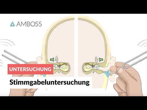 Tuning fork tests according to Rinne and Weber - AMBOSS Video - Rinne test Weber test