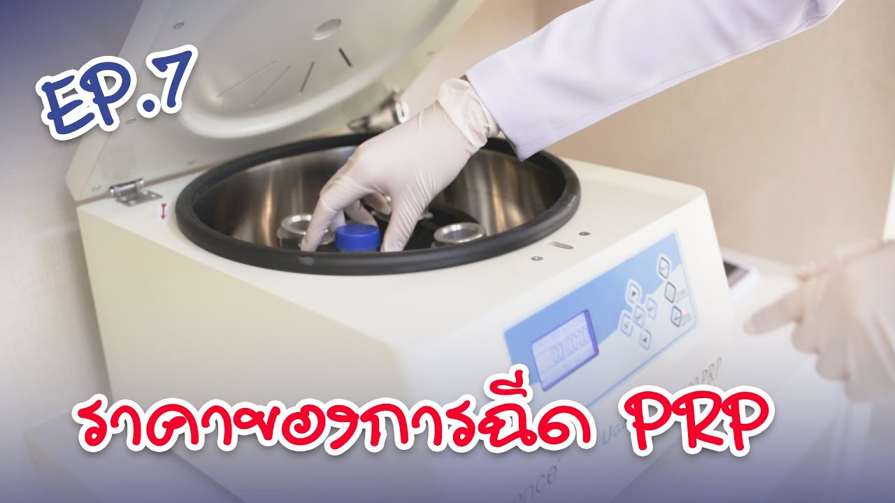 ราคาการฉีด PRP | EP.7