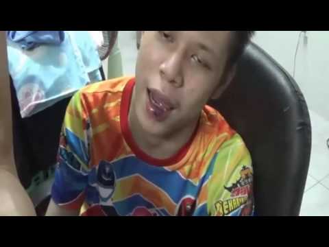 โรคสะเก็ดเงินเกลือ ทำให้รุนแรงขึ้นของกลากแห้ง
