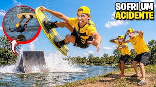 ERA PRA SER UM DIA SURFANDO … *Sofri um acidente ! 