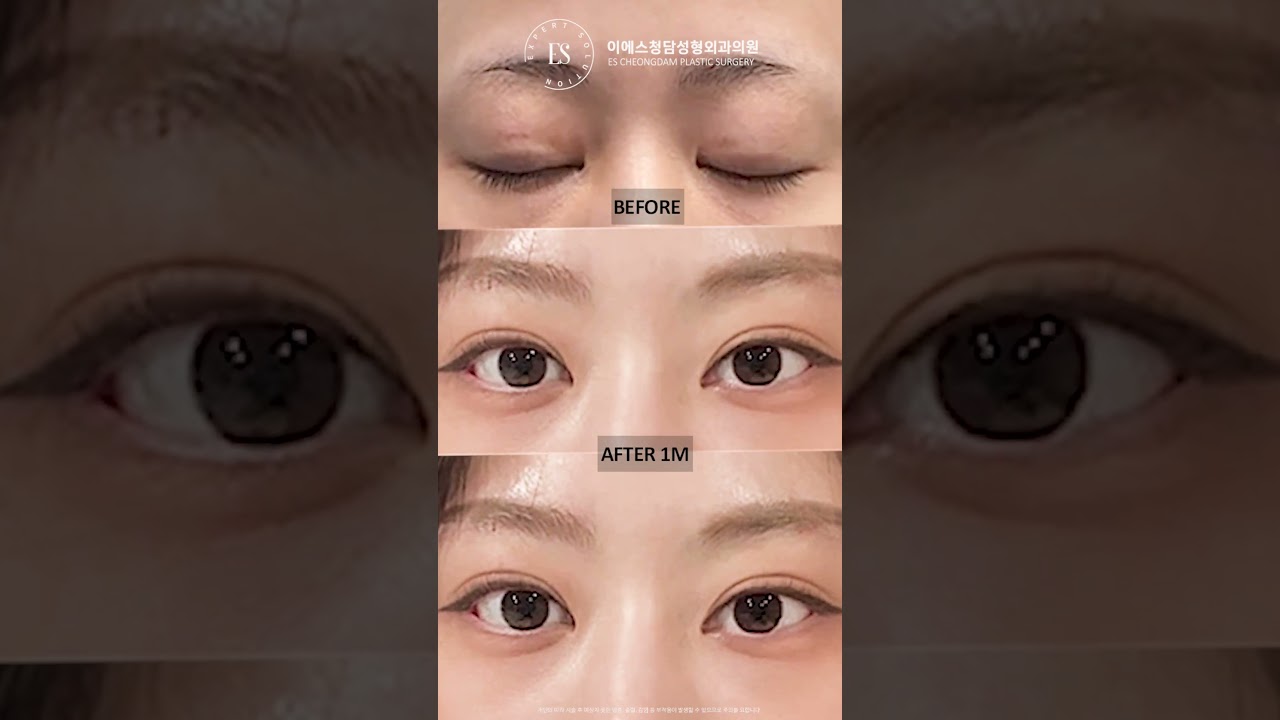 이에스 유튜브