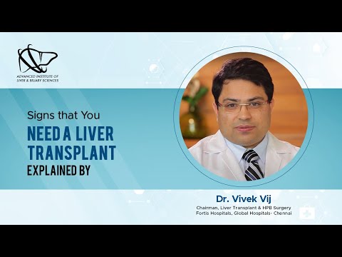 Signs that You Need a Liver Transplant | Liver Surgeon | Dr. Vivek Vij