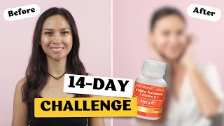Watch the d-Alpha Tocopherol (Myra E) 14-Day Challenge