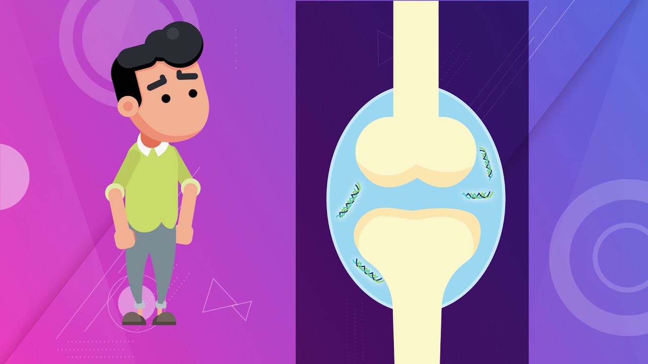 Colágeno No Hidrolizado Tipo II (UCII) en la Osteoartritis / Artritis 💊✔️ | Expertos en OA