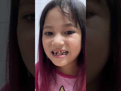 MY TOOTH FLIPPED OUT 😱 #shorts