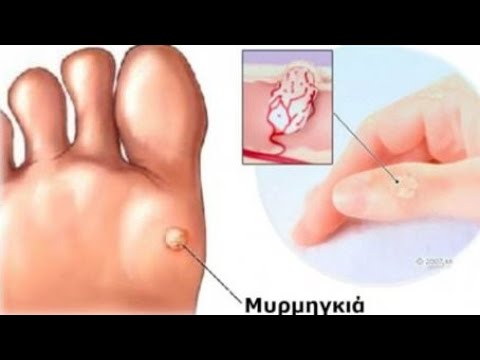 Μασάζ ελέφαντας πορνό