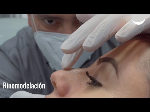 ¡Transforma tu nariz en 5 minutos!