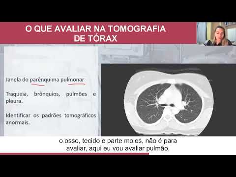 FISIOTERAPEUTA, O QUE AVALIAR NA TOMOGRAFIA DE TÓRAX.