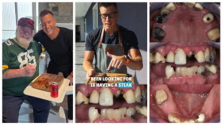 My Dentist Grilled Me a Juicy Steak 🥩 😋 the Day I Got My Dental Implant Smile 😭🔥
