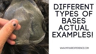 Hair replacement Men's Hair System Review Different Base Materials, Actual Examples