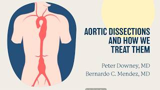 Aortic Dissection: How It’s Treated | UCLA Health Aortic Care