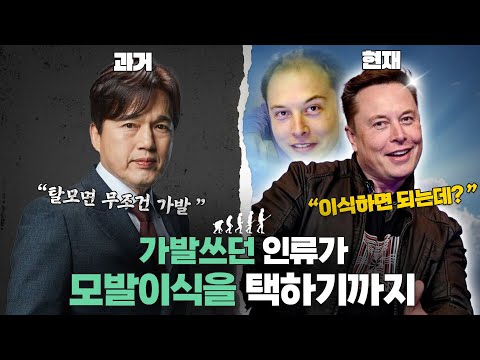 내 머리를 갖는 게 이렇게나 소중합니다.. [탈모를 파헤치다]