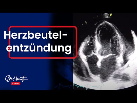 5 HWS Injektionen für Arthritis des Gelenkes