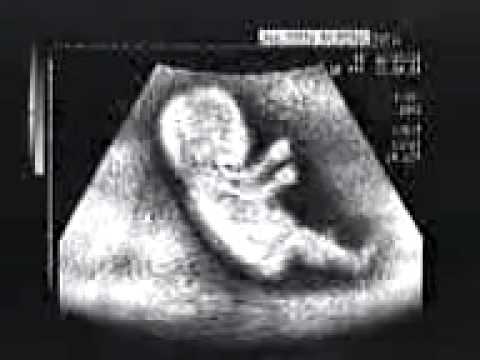 download lagu mp3 mp4 Www Tamilwap, download lagu Www Tamilwap gratis, unduh video klip Www Tamilwap