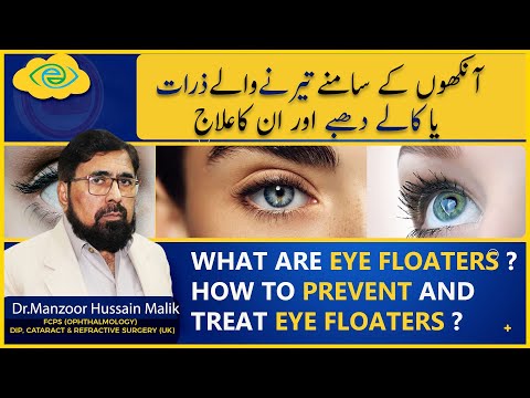 What are  Eye Floaters ? How to prevent and treat Eye Floaters ? | Urdu Hindi