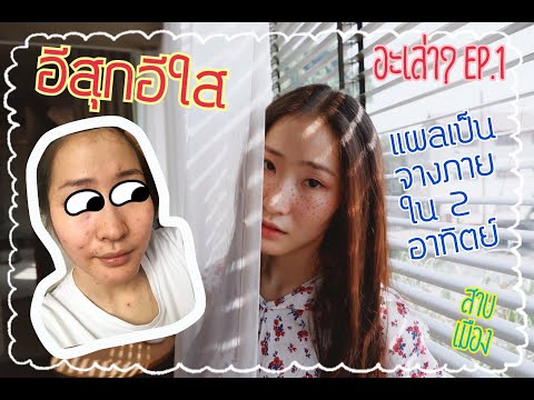 คลิกเพื่อดูคลิปวิดีโอ