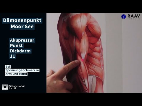 Bei Tennisarm und Ellenbogenschmerz mit Ausstrahlung in Unterarm - Akupressurpunkt Dickdarm 11
