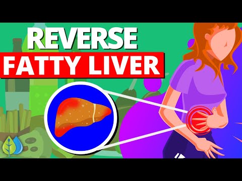, title : 'Top 10 Foods that Reverse Fatty Liver'