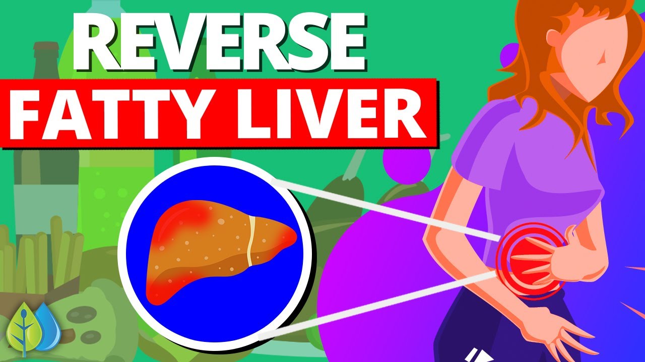 Top 10 Foods that Reverse Fatty Liver