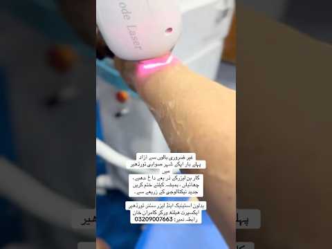 Hand laser hair removal treatment #skincare #views #views #shortsvideo #subscribers