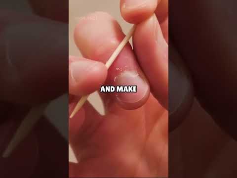 How To Throw Toothpicks😨