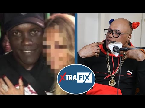 Kaseeno on How a Doctor Recommended Bleaching Cream for Disfigured Face || Xtra Fix