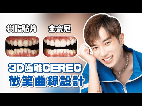 - YouTube