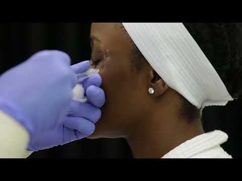 Botox Nigeria