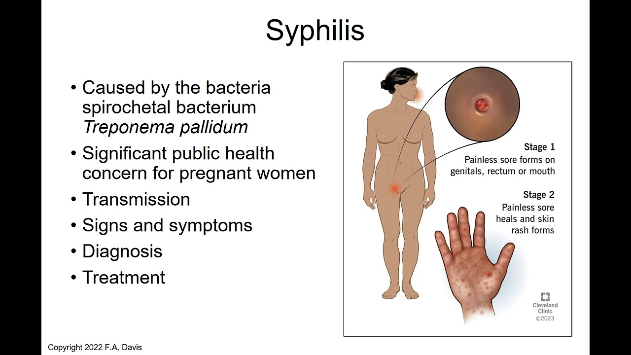 RNSG 2910 Chapter 32 PowerPoint   audio