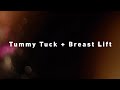 Tummy Tuck Breast Lift